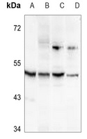 ALDH3B2 antibody