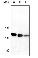 Anti-CD13 Antibody