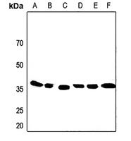 Anti-Apolipoprotein F Antibody