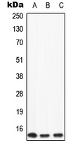 Anti-Apolipoprotein C2 Antibody