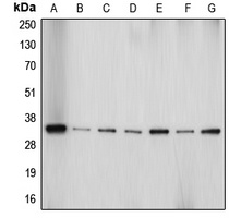 Aquaporin 4 antibody