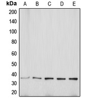 Anti-Aquaporin 5 Antibody