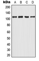 Androgen R (phospho-Y363) antibody