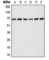 Anti-A-RAF (Phospho-Y302) Antibody