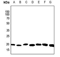 Anti-ARF6 Antibody