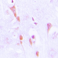 Beta-arrestin-1 (Phospho-S412) Rabbit Polyclonal Antibody