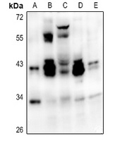 ATF1 antibody