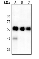 Anti-ATF4 Antibody