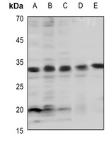 Anti-BCL2 (Phospho-T69) Antibody