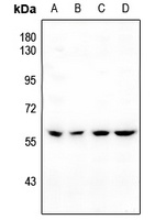 Anti-BMP5 Antibody