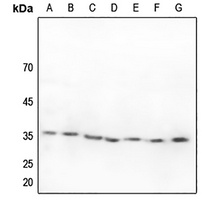 Anti-ZFP36L1 Antibody