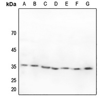 ZFP36L1 antibody