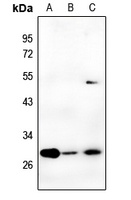 CA2 antibody