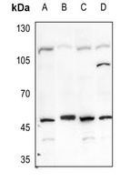 Anti-Carbonic Anhydrase 9 Antibody