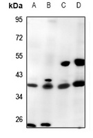 Anti-Caspase 1 Antibody