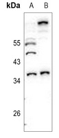 Anti-Caspase 7 Antibody