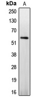 Caspase 8 (phospho-S347) antibody