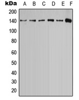 Calcium Sensing R (phospho-T888) antibody