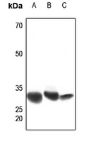 Prostaglandin-E(2) 9-reductase antibody