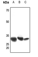 Anti-CBR1 Antibody
