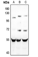 Anti-CD4 Antibody