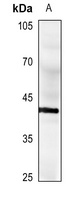 Anti-CD40 Antibody