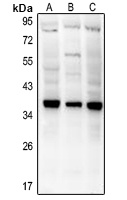 Anti-CD154 Antibody