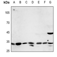 Anti-CD58 Antibody