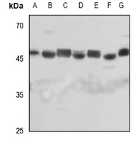 Anti-Septin 7 Antibody