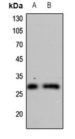 CDC34 antibody