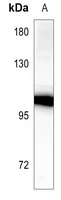 CDH18 antibody