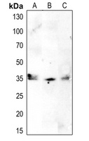 CDK1/2/3 (phospho-T14) antibody