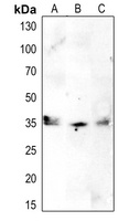 Anti-CDK1/2/3 (Phospho-T14) Antibody