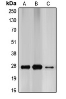CDKN1B antibody