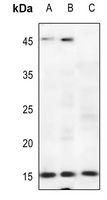 CDKN2B antibody