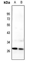 Anti-C/EBP delta/epsilon Antibody