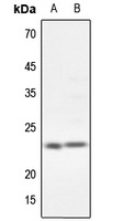 Anti-CG beta Antibody