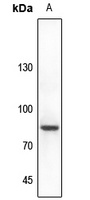 Chat antibody