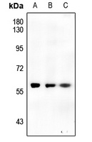 CHEK1 (phospho-S317) antibody
