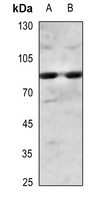 Anti-IKK alpha/beta (Phospho-S180/181) Antibody