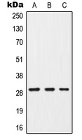 CISH antibody