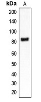 Anti-CLCN4 Antibody