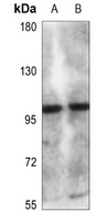 CLCN6 antibody