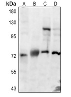 CLCN7 antibody
