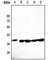 Anti-CLNS1A Antibody