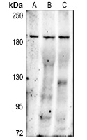 MRP2 antibody
