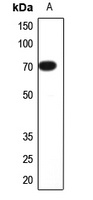 Anti-CNGA2 Antibody