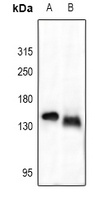 Anti-Collagen 1 alpha 2 Antibody