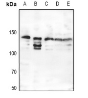 Anti-Collagen 3 alpha 1 Antibody