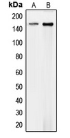 Anti-Collagen 4 alpha 1 Antibody